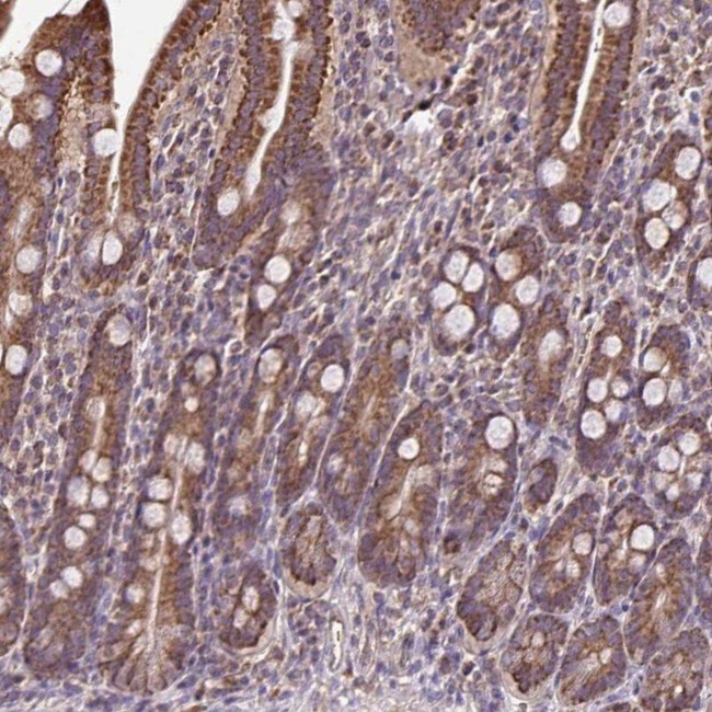 MAN1A1 Antibody in Immunohistochemistry (IHC)