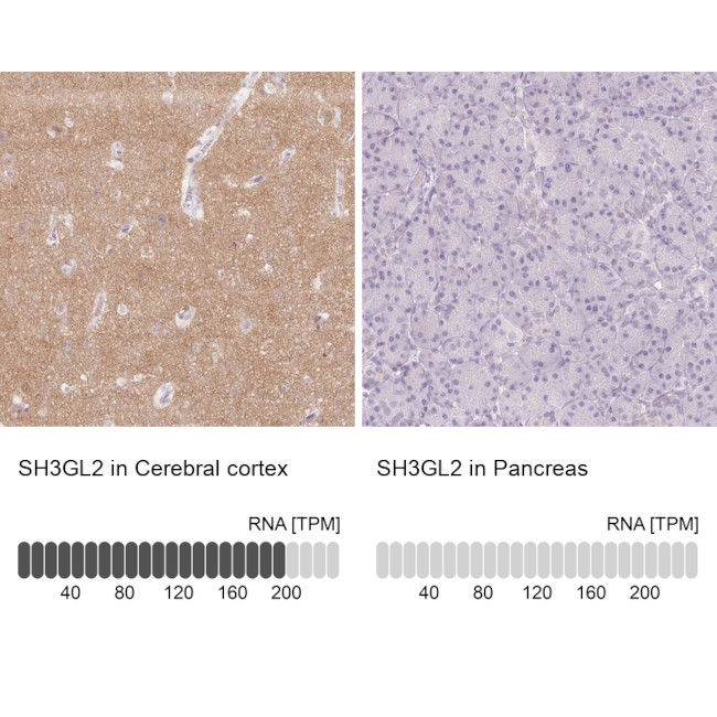 SH3GL2 Antibody in Immunohistochemistry (IHC)