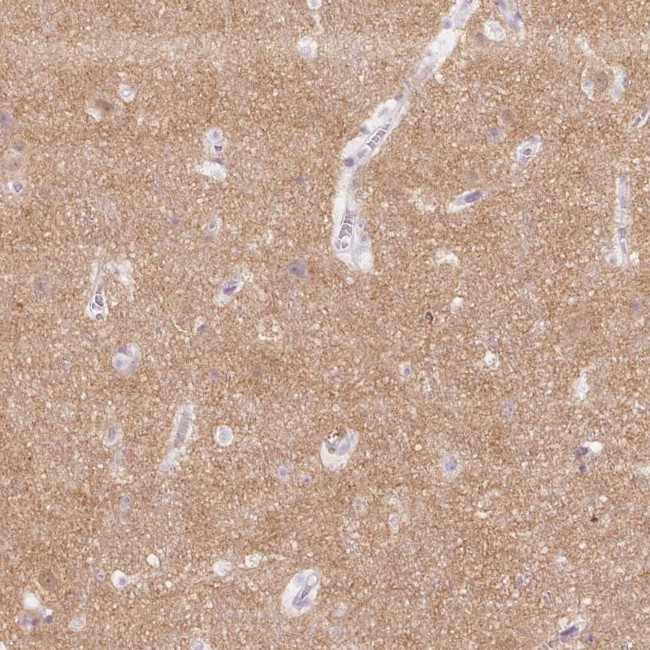 SH3GL2 Antibody in Immunohistochemistry (IHC)