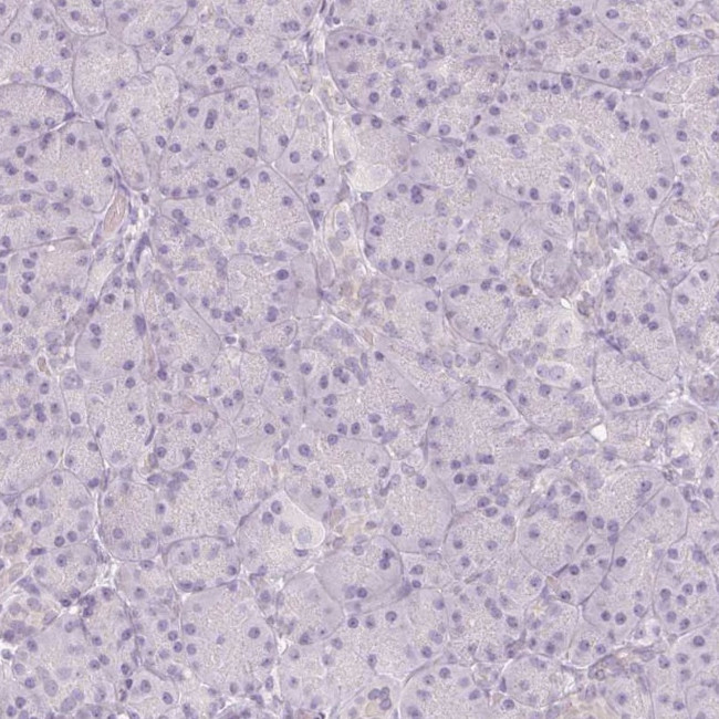 SH3GL2 Antibody in Immunohistochemistry (IHC)