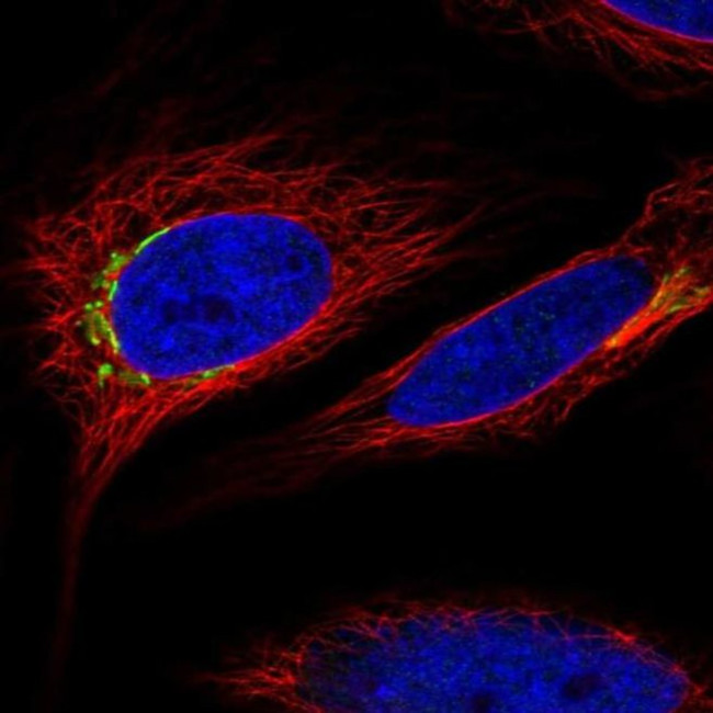 MARCO Antibody in Immunocytochemistry (ICC/IF)