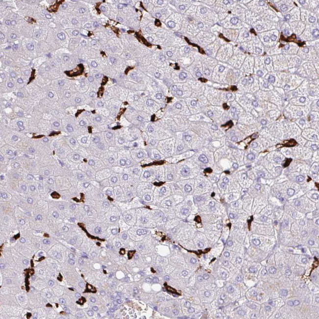 MARCO Antibody in Immunohistochemistry (IHC)