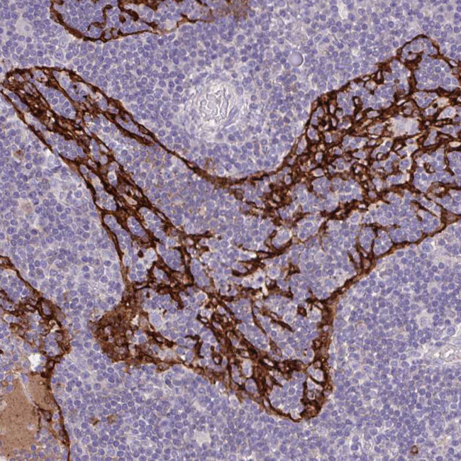 MARCO Antibody in Immunohistochemistry (IHC)