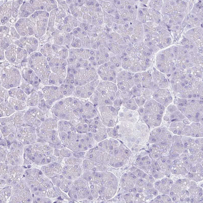 MARCO Antibody in Immunohistochemistry (IHC)