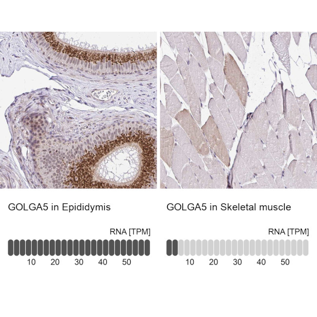 GOLGA5 Antibody in Immunohistochemistry (IHC)