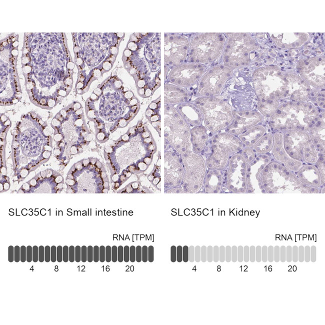 SLC35C1 Antibody in Immunohistochemistry (IHC)