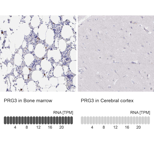 PRG3 Antibody in Immunohistochemistry (IHC)