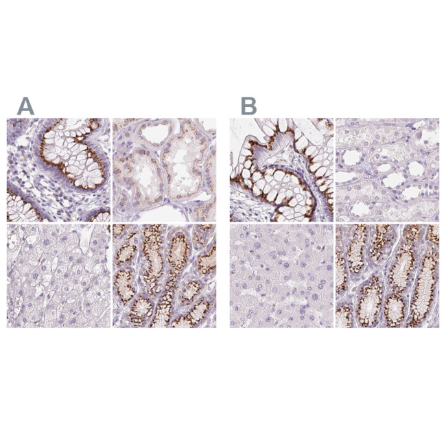 GALNT7 Antibody in Immunohistochemistry (IHC)