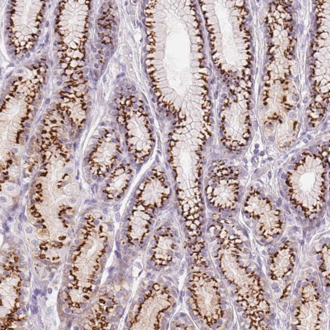 GALNT7 Antibody in Immunohistochemistry (IHC)