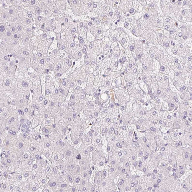 GALNT7 Antibody in Immunohistochemistry (IHC)