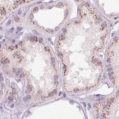 GALNT7 Antibody in Immunohistochemistry (IHC)