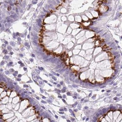 GALNT7 Antibody in Immunohistochemistry (IHC)