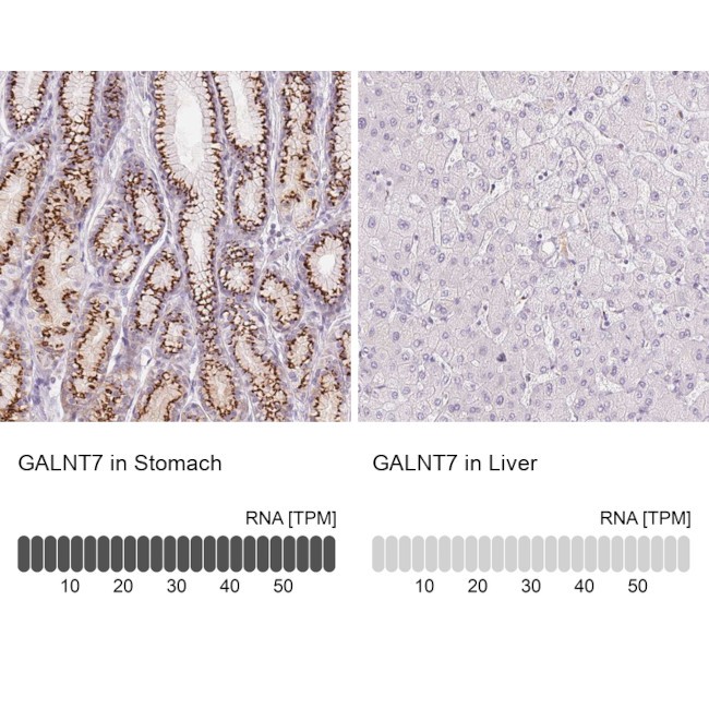 GALNT7 Antibody