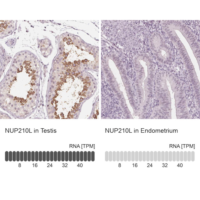 NUP210L Antibody in Immunohistochemistry (IHC)