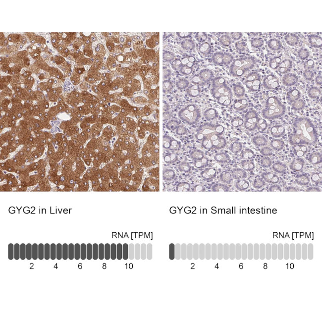 GYG2 Antibody in Immunohistochemistry (IHC)