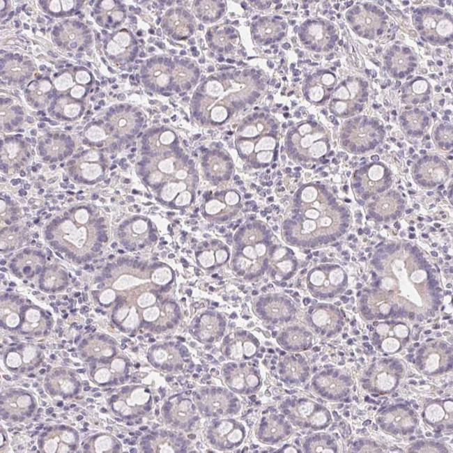 GYG2 Antibody in Immunohistochemistry (IHC)