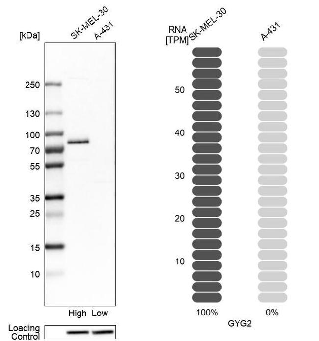 GYG2 Antibody in Western Blot (WB)