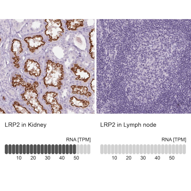 LRP2 Antibody in Immunohistochemistry (IHC)