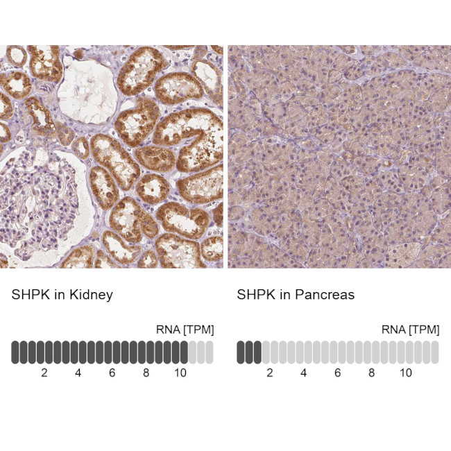 CARKL Antibody in Immunohistochemistry (IHC)