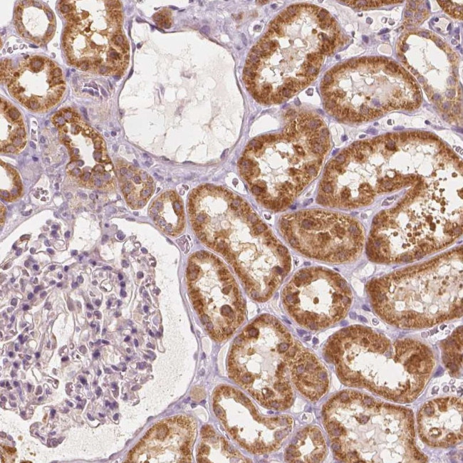 CARKL Antibody in Immunohistochemistry (IHC)