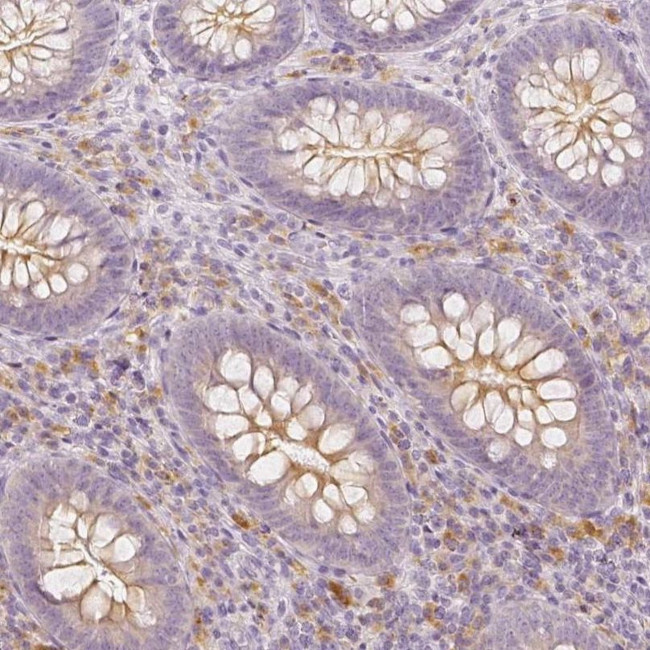 BATF Antibody in Immunohistochemistry (IHC)