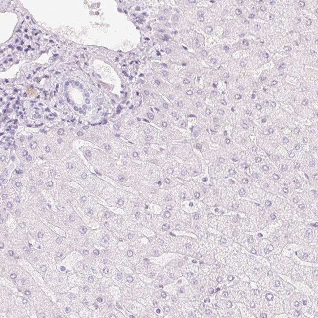 HOXB13 Antibody in Immunohistochemistry (IHC)