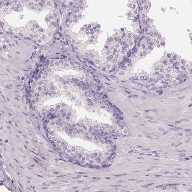 HSD17B1 Antibody in Immunohistochemistry (IHC)