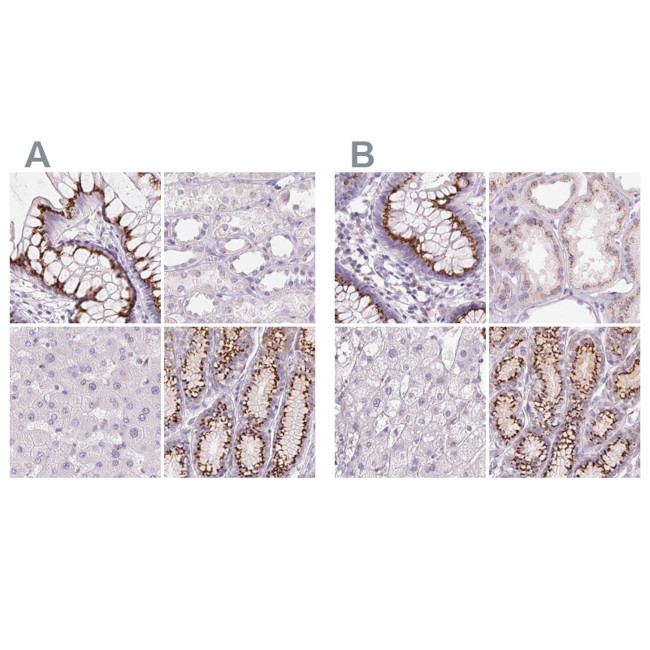 GALNT7 Antibody in Immunohistochemistry (IHC)