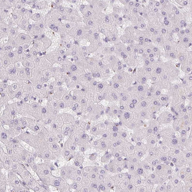 GALNT7 Antibody in Immunohistochemistry (IHC)