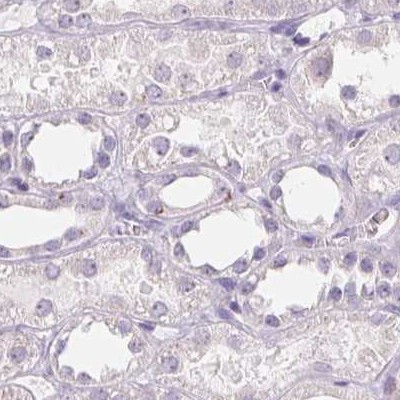 GALNT7 Antibody in Immunohistochemistry (IHC)