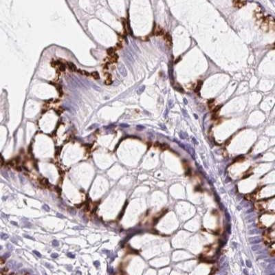 GALNT7 Antibody in Immunohistochemistry (IHC)