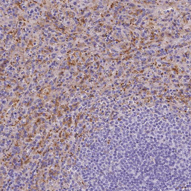 Ferroportin Antibody in Immunohistochemistry (IHC)