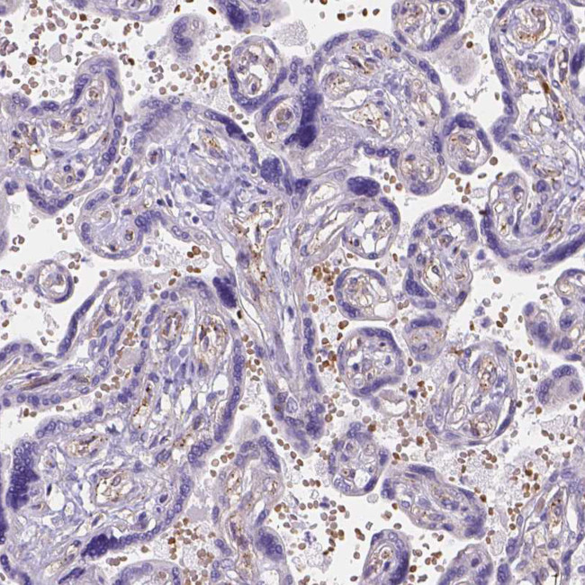 Ferroportin Antibody in Immunohistochemistry (IHC)