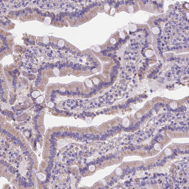 Ferroportin Antibody in Immunohistochemistry (IHC)