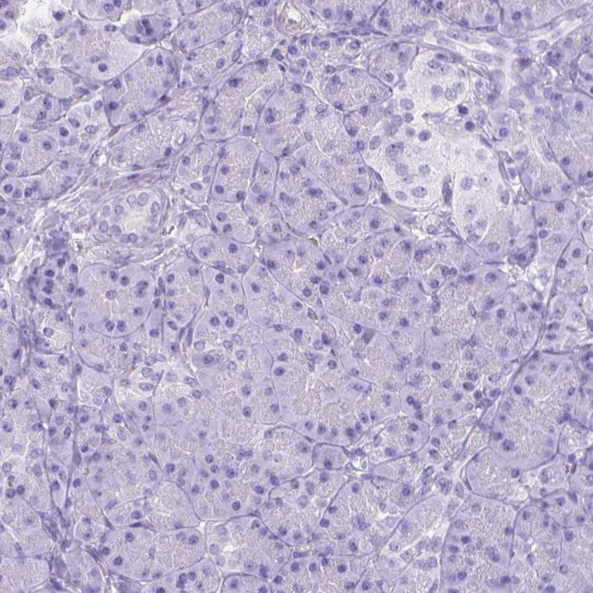 Ferroportin Antibody in Immunohistochemistry (IHC)