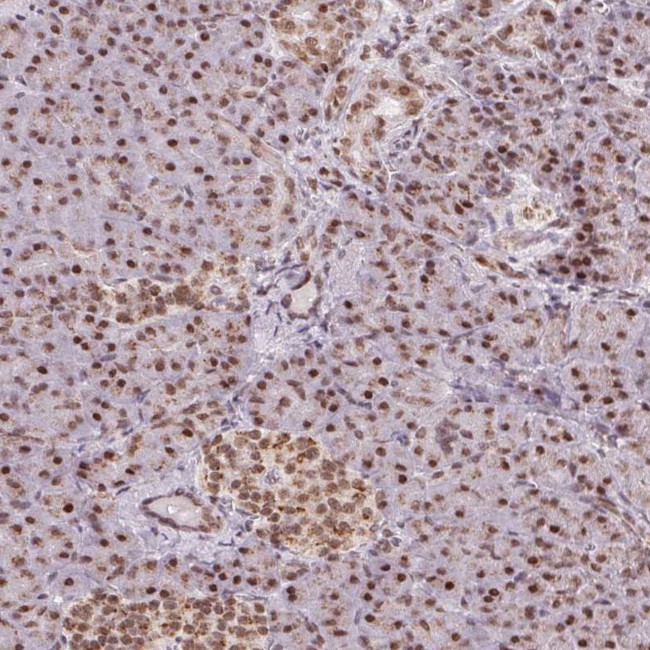 TOPORS Antibody in Immunohistochemistry (IHC)