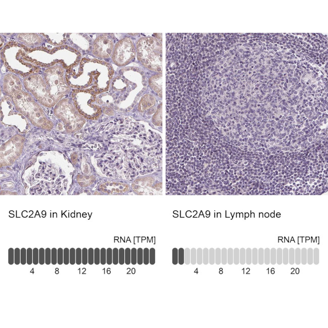 GLUT9 Antibody in Immunohistochemistry (IHC)