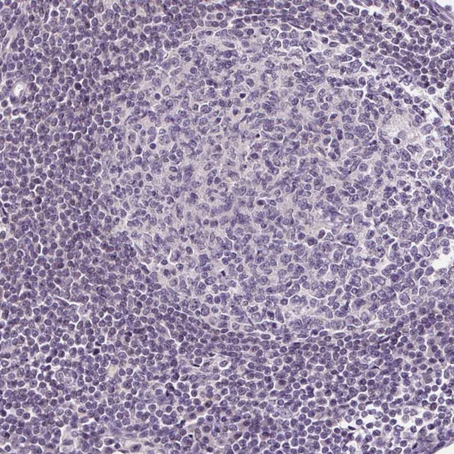 GLUT9 Antibody in Immunohistochemistry (IHC)