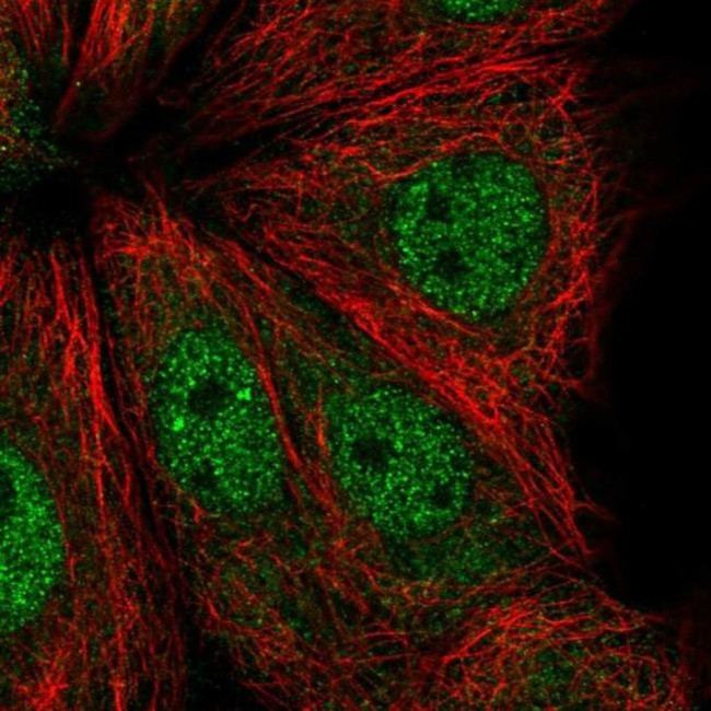 ADPRHL1 Antibody in Immunocytochemistry (ICC/IF)