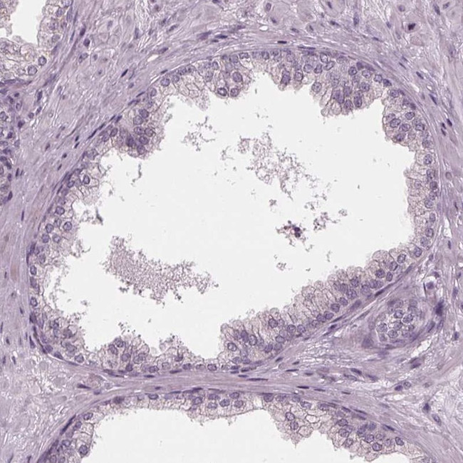 ADPRHL1 Antibody in Immunohistochemistry (IHC)