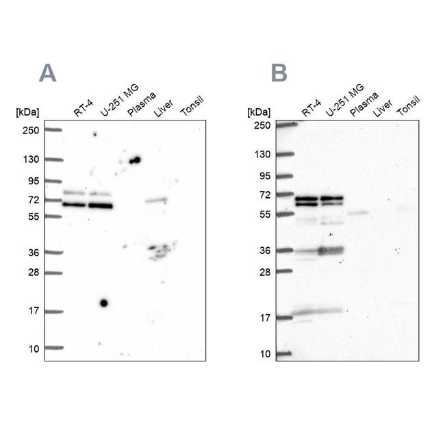 GTF3C5 Antibody in Western Blot (WB)