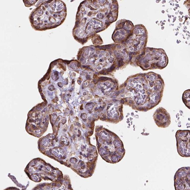 Importin 11 Antibody in Immunohistochemistry (IHC)