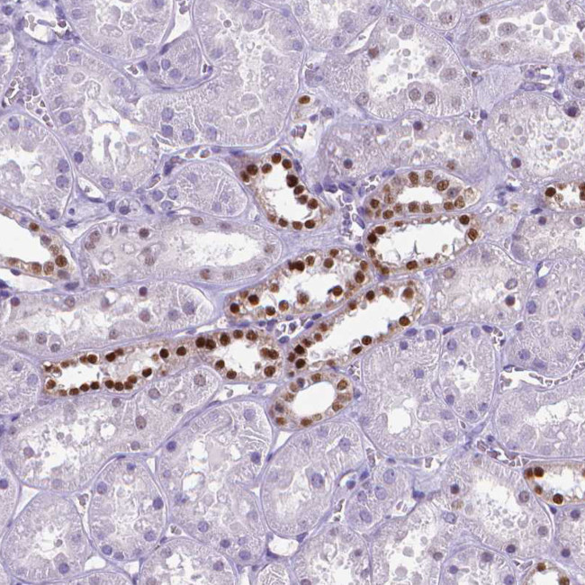 POU3F3 Antibody in Immunohistochemistry (IHC)