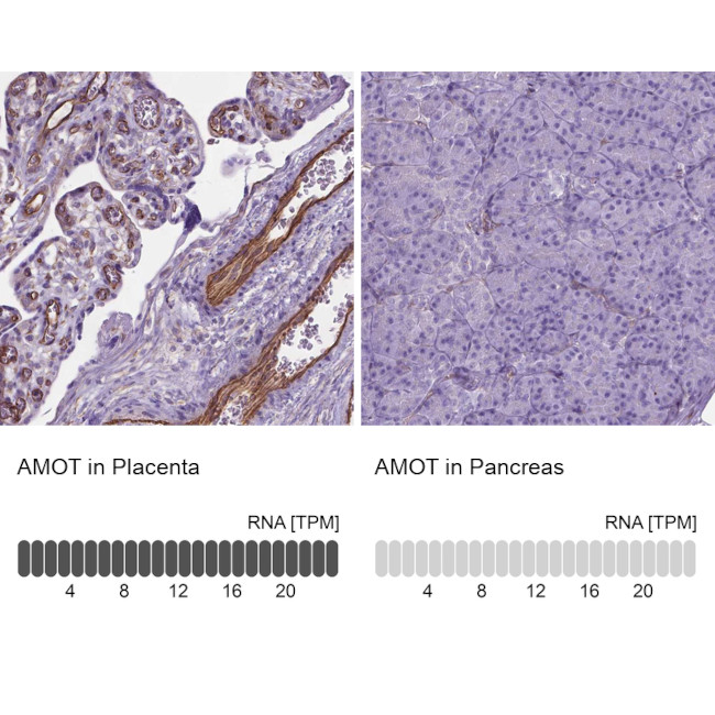 AMOT Antibody in Immunohistochemistry (IHC)