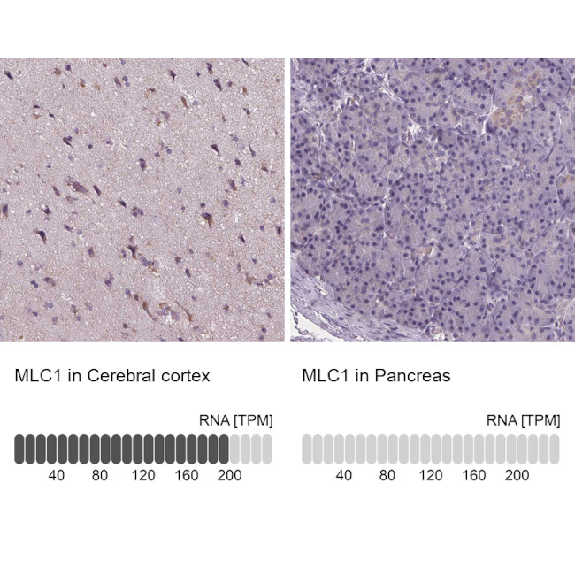 MLC1 Antibody in Immunohistochemistry (IHC)