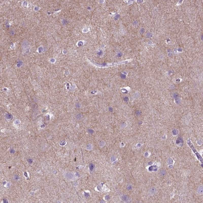 GABRB2 Antibody in Immunohistochemistry (IHC)