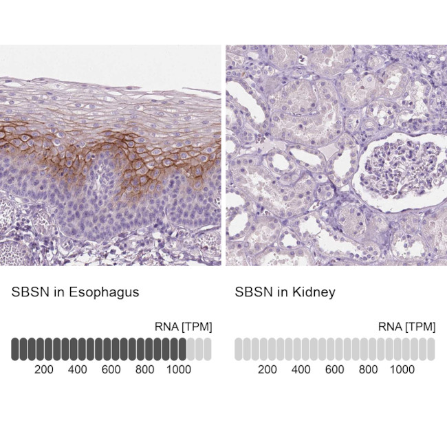 SBSN Antibody in Immunohistochemistry (IHC)