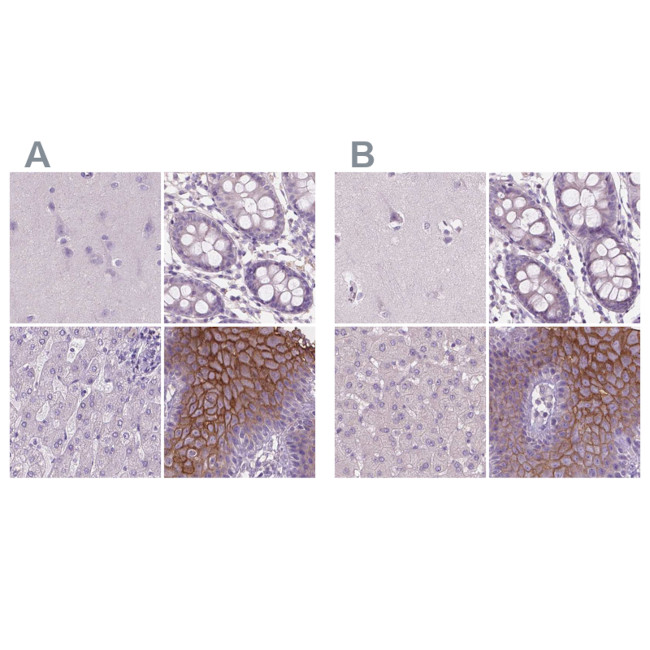 SBSN Antibody in Immunohistochemistry (IHC)