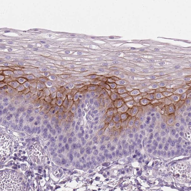 SBSN Antibody in Immunohistochemistry (IHC)