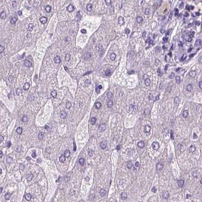 SBSN Antibody in Immunohistochemistry (IHC)